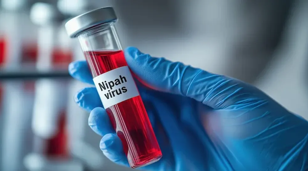 Nipah Virus